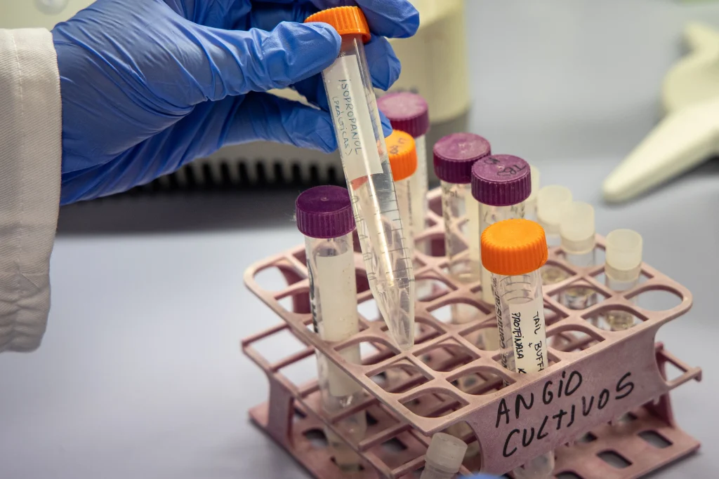 La investigación del CIBIR estudia una terapia génica contra el Alzheimer