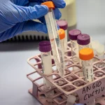 La investigación del CIBIR estudia una terapia génica contra el Alzheimer